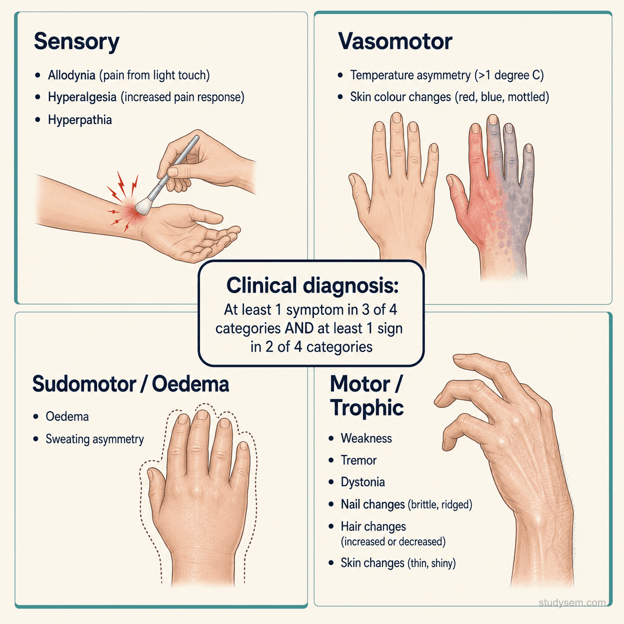 Four-quadrant diagram of the Budapest diagnostic criteria for CRPS, organised by the four feature categories: sensory (hyperaesthesia, allodynia), vasomotor (temperature asymmetry, skin colour changes), sudomotor/oedema (swelling, sweating asymmetry), and motor/trophic (decreased ROM, weakness, tremor, dystonia, hair, nail, and skin changes). Caption notes the clinical diagnosis requires at least one symptom in 3 of 4 categories and at least one sign in 2 of 4 categories.
