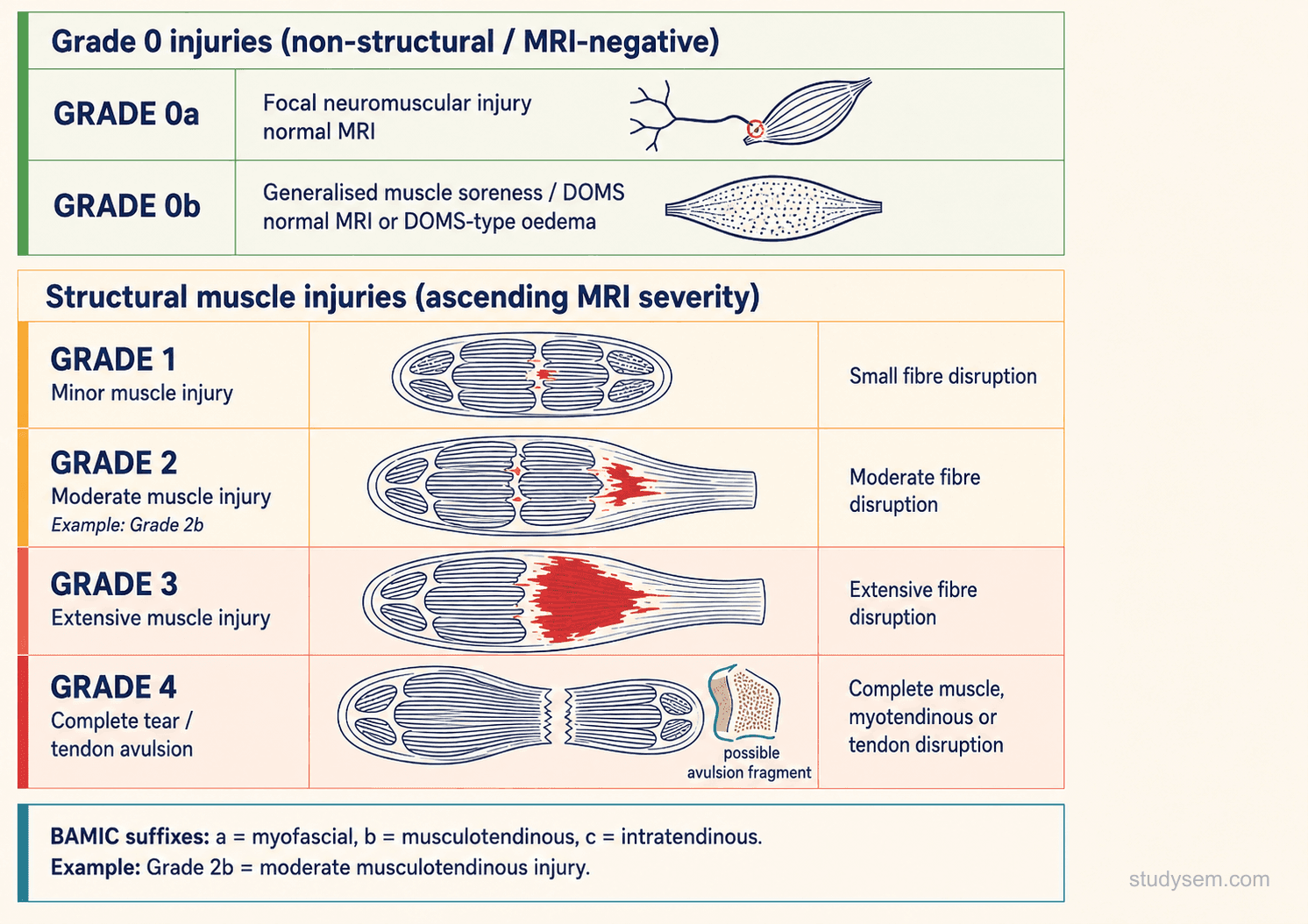 British Athletics Muscle Injury Classification (BAMIC) diagram showing functional (grade 0) through structural (grades 1-4) injuries with sub-site suffixes a (myofascial), b (musculotendinous junction), and c (intratendinous).