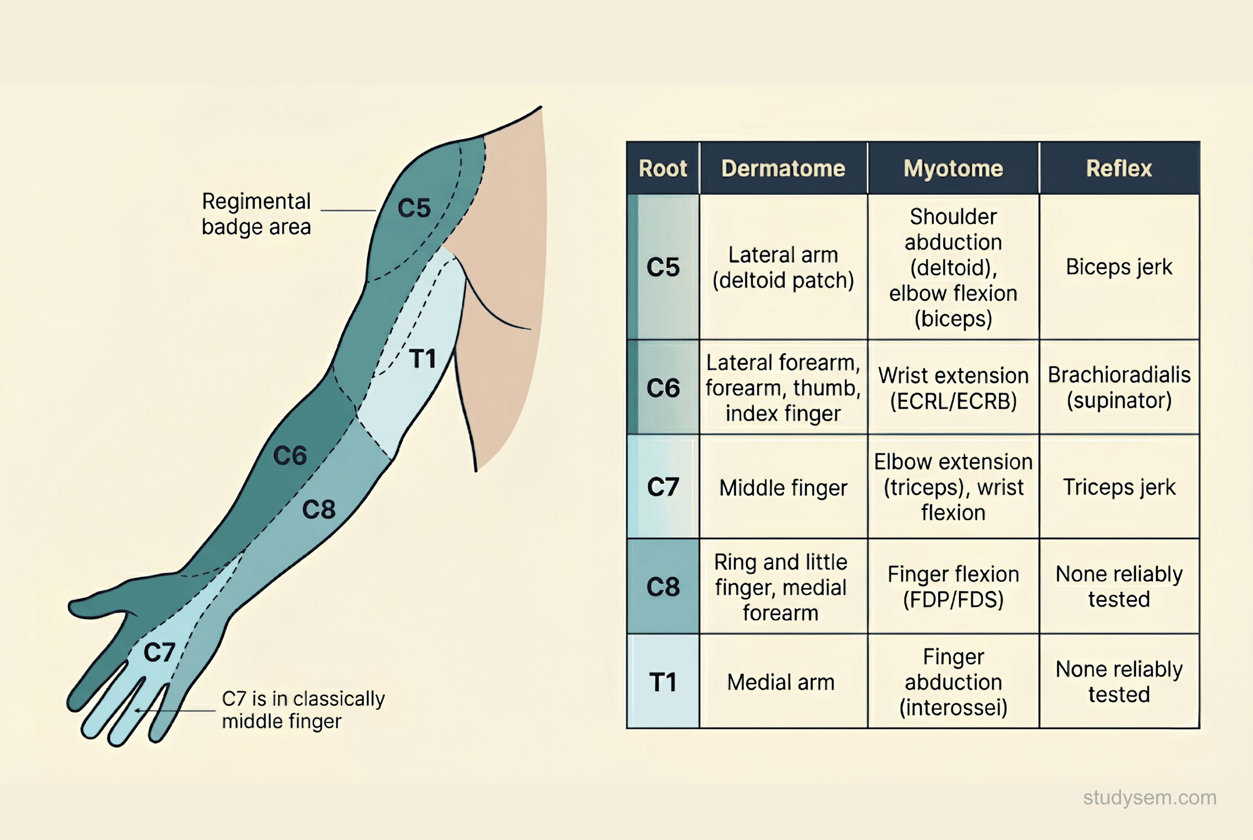Upper limb dermatome map with myotome and reflex reference table showing C5 to T1 distributions for level localisation in cervical radiculopathy