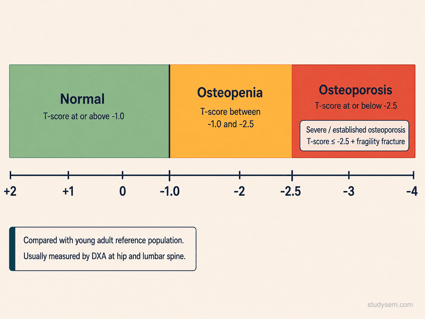 DEXA bone density distribution diagram with WHO T-score classification bands: normal (T at or above -1.0), osteopenia (-1.0 to -2.5), osteoporosis (-2.5 or below), and severe osteoporosis (-2.5 or below in the presence of a fragility fracture)