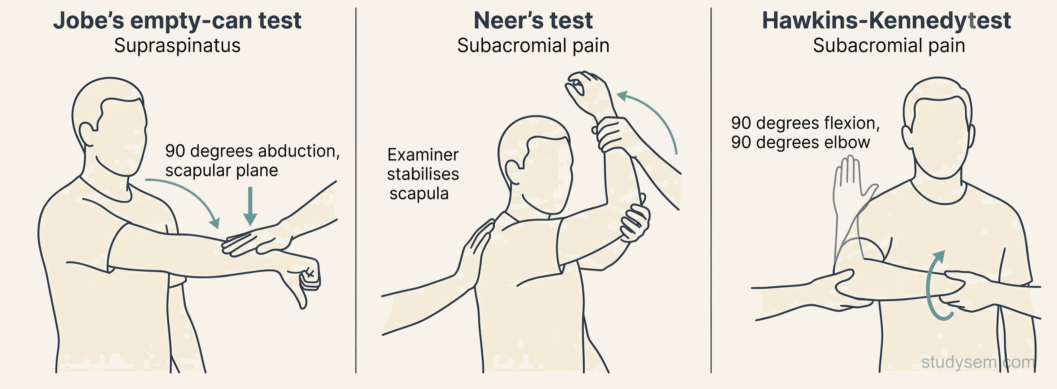 Three side-by-side examination diagrams: Jobe's empty-can test for supraspinatus, Neer's test for subacromial pain, and Hawkins-Kennedy test for subacromial pain