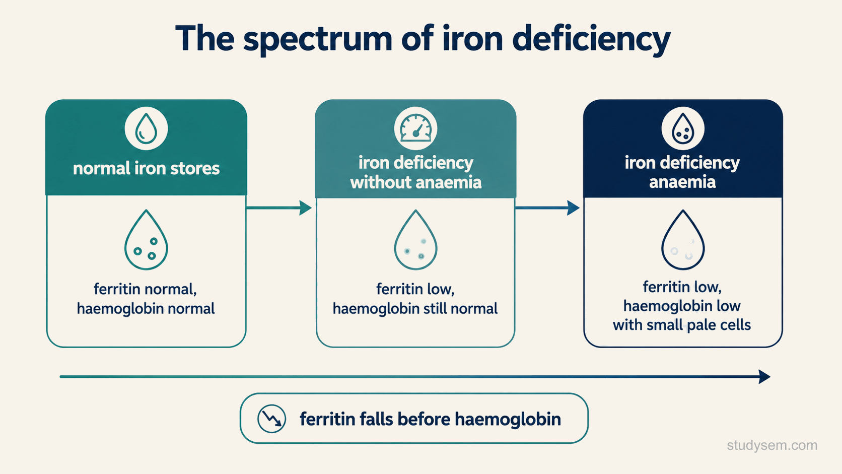 A left-to-right spectrum of iron deficiency, from normal iron stores with normal ferritin and normal haemoglobin, through iron deficiency without anaemia with low ferritin but still normal haemoglobin, to iron deficiency anaemia with low ferritin and low haemoglobin and small pale cells, showing that ferritin falls before haemoglobin.