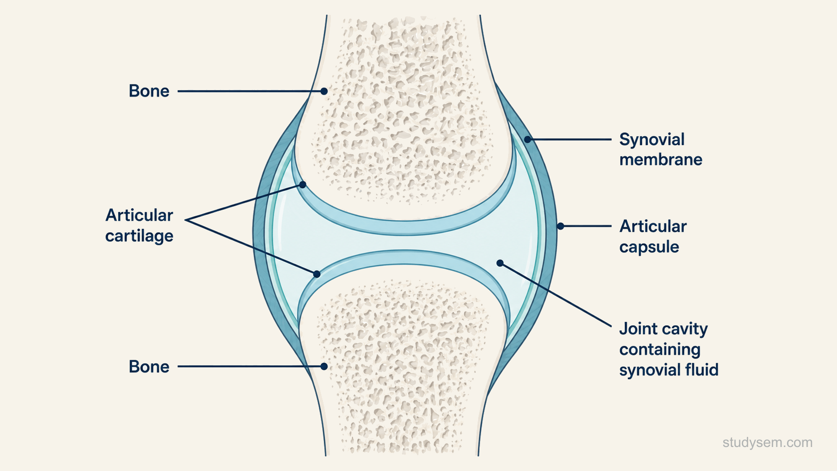 A cross-section of a generic synovial joint showing two bone ends each capped with a smooth layer of articular hyaline cartilage, a joint capsule with an outer fibrous layer and an inner synovial membrane, a fluid-filled joint cavity between the cartilage surfaces containing synovial fluid, and a reinforcing ligament alongside the capsule.