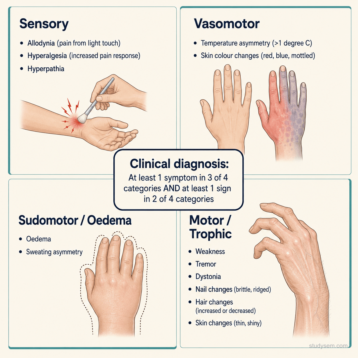 Four-quadrant diagram of the Budapest diagnostic criteria for CRPS, organised by the four feature categories: sensory (hyperaesthesia, allodynia), vasomotor (temperature asymmetry, skin colour changes), sudomotor/oedema (swelling, sweating asymmetry), and motor/trophic (decreased ROM, weakness, tremor, dystonia, hair, nail, and skin changes). Caption notes the clinical diagnosis requires at least one symptom in 3 of 4 categories and at least one sign in 2 of 4 categories.