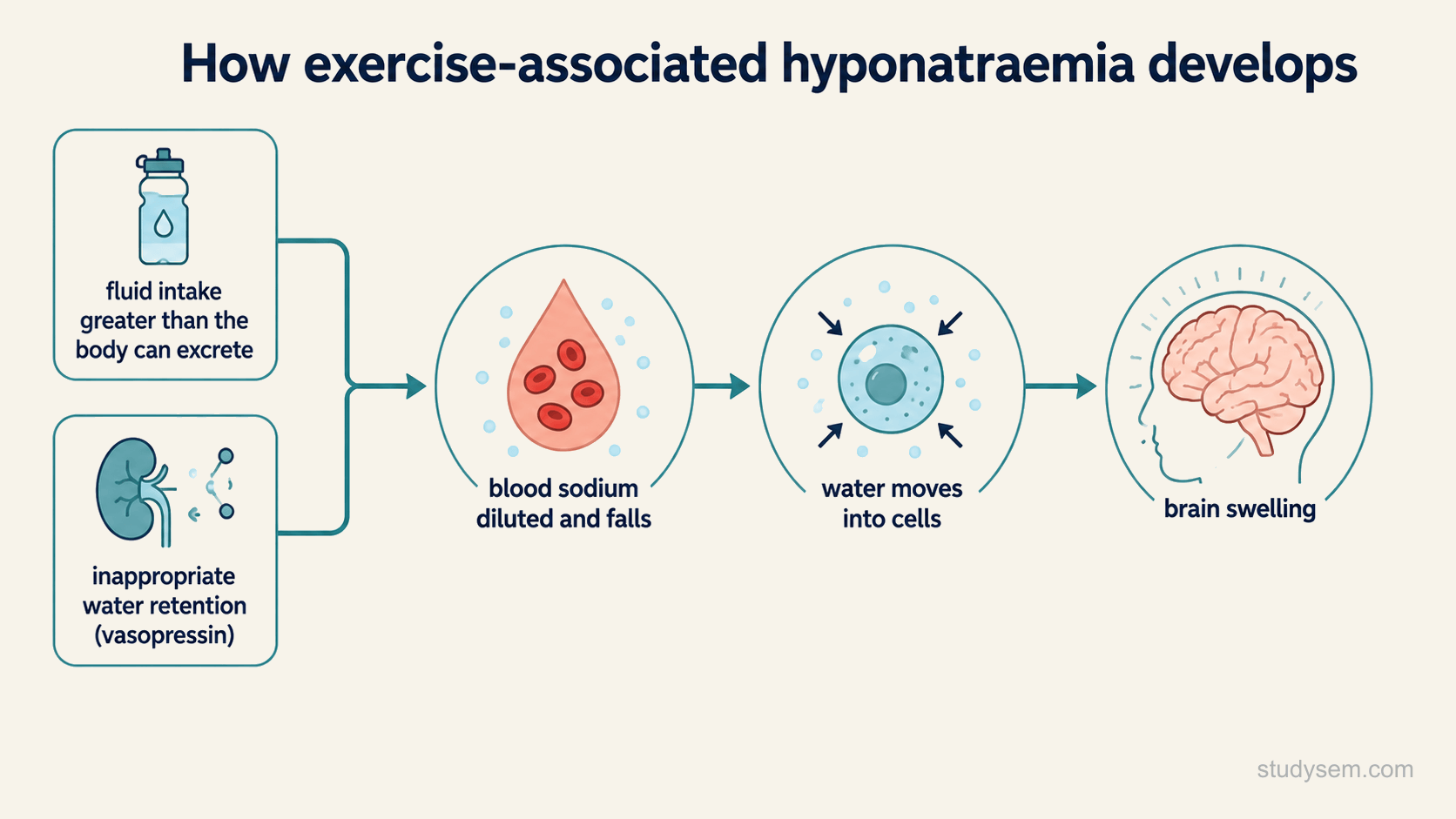 A cause-to-consequence chain: drinking more fluid than the body can excrete, together with inappropriate water retention, dilutes the blood sodium, water then moves into the cells, and the brain swells.