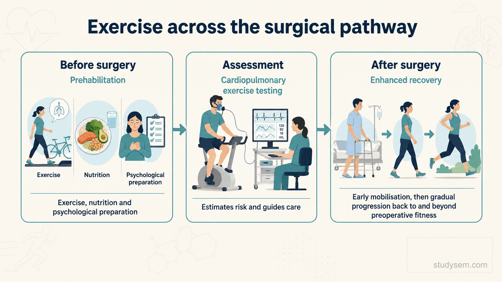 A clean horizontal timeline on a cream background titled 'Exercise across the surgical pathway'. Three stages left to right with understated arrows: 'Before surgery' labelled prehabilitation with exercise, nutrition and psychological preparation; 'Assessment' labelled cardiopulmonary exercise testing to estimate risk and guide care; and 'After surgery' labelled early mobilisation within enhanced recovery, then gradual progression back to and beyond preoperative fitness. Flat navy and teal on cream, Inter typeface.
