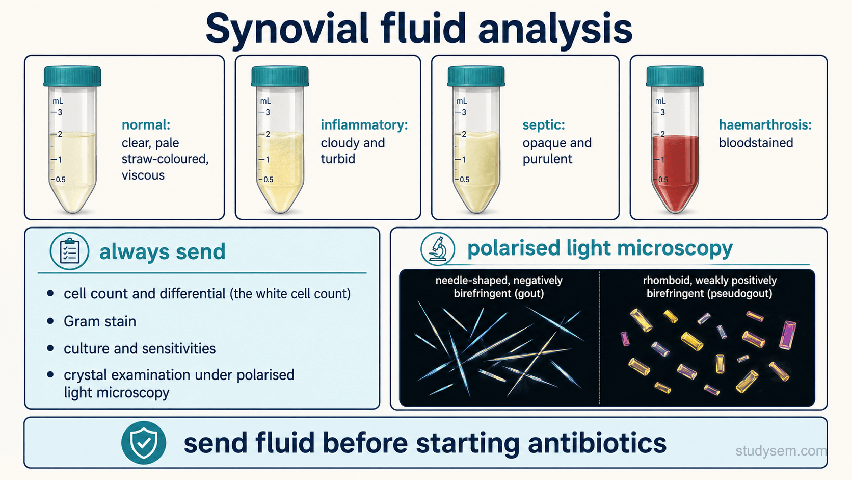An educational figure titled 'Synovial fluid analysis'. A row of sample tubes shows fluid appearances with labels: normal fluid is clear, pale straw-coloured and viscous; inflammatory fluid is cloudy and turbid; septic fluid is opaque and purulent; and a haemarthrosis is bloodstained. A bordered panel headed 'always send' lists: cell count and differential (the white cell count), Gram stain, culture and sensitivities, and crystal examination under polarised light microscopy. A separate microscopy inset accurately depicts two crystal types under polarised light: monosodium urate crystals shown as long needle shapes that are negatively birefringent, seen in gout; and calcium pyrophosphate crystals shown as short rhomboid shapes that are weakly positively birefringent, seen in pseudogout. A footer note reads: send fluid before starting antibiotics.