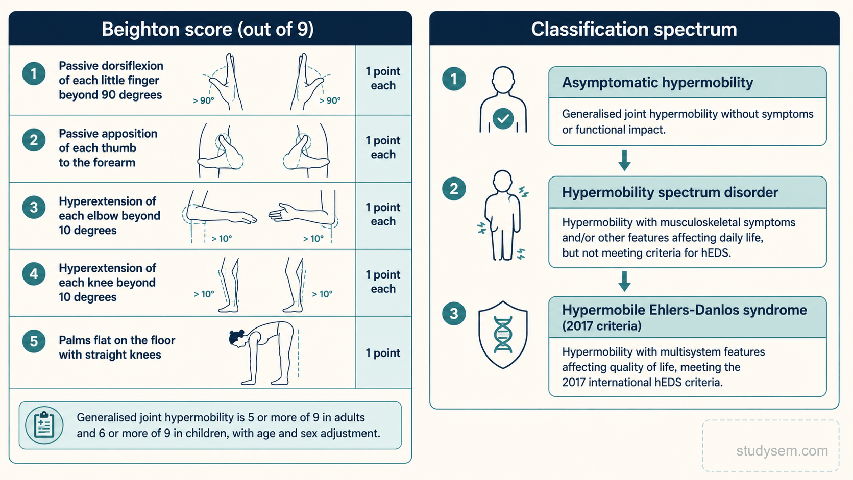 A figure in two parts. The Beighton score is out of 9 across five manoeuvres: passive dorsiflexion of each little finger beyond 90 degrees, passive apposition of each thumb to the forearm, hyperextension of each elbow beyond 10 degrees, hyperextension of each knee beyond 10 degrees, and placing the palms flat on the floor with straight knees. Under the 2017 criteria, generalised joint hypermobility is at least 6 before puberty, at least 5 from puberty to age 50, and at least 4 over age 50, with no separate sex cut-off. Classification shows asymptomatic hypermobility, hypermobility spectrum disorder and hypermobile Ehlers-Danlos syndrome as distinct diagnoses with substantial overlap, not a single severity ladder.