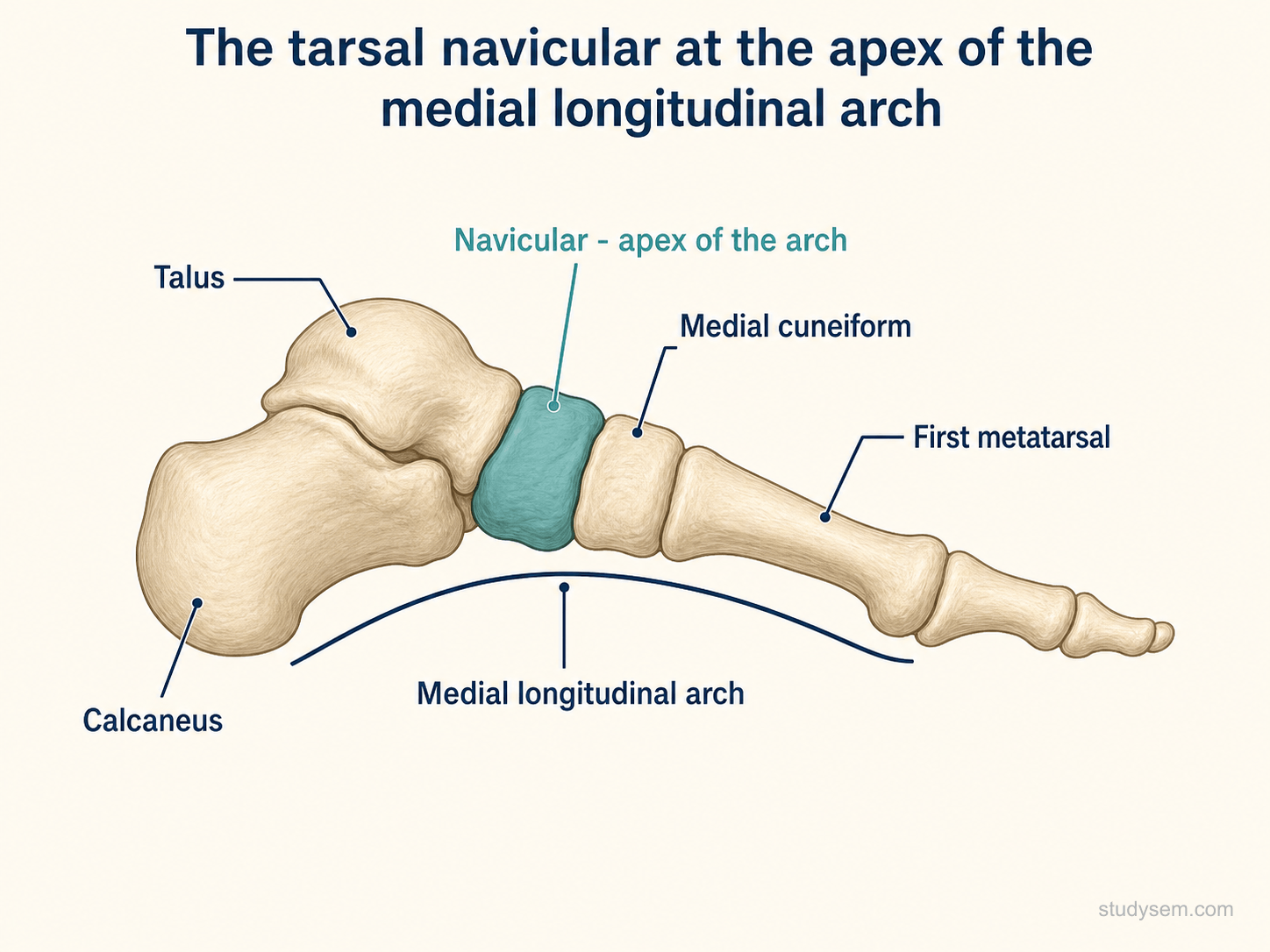 Lateral diagram of the bones of the foot with the tarsal navicular highlighted at the apex of the medial longitudinal arch, between the head of the talus and the medial cuneiform; the calcaneus, first metatarsal and the curve of the medial longitudinal arch are also labelled.