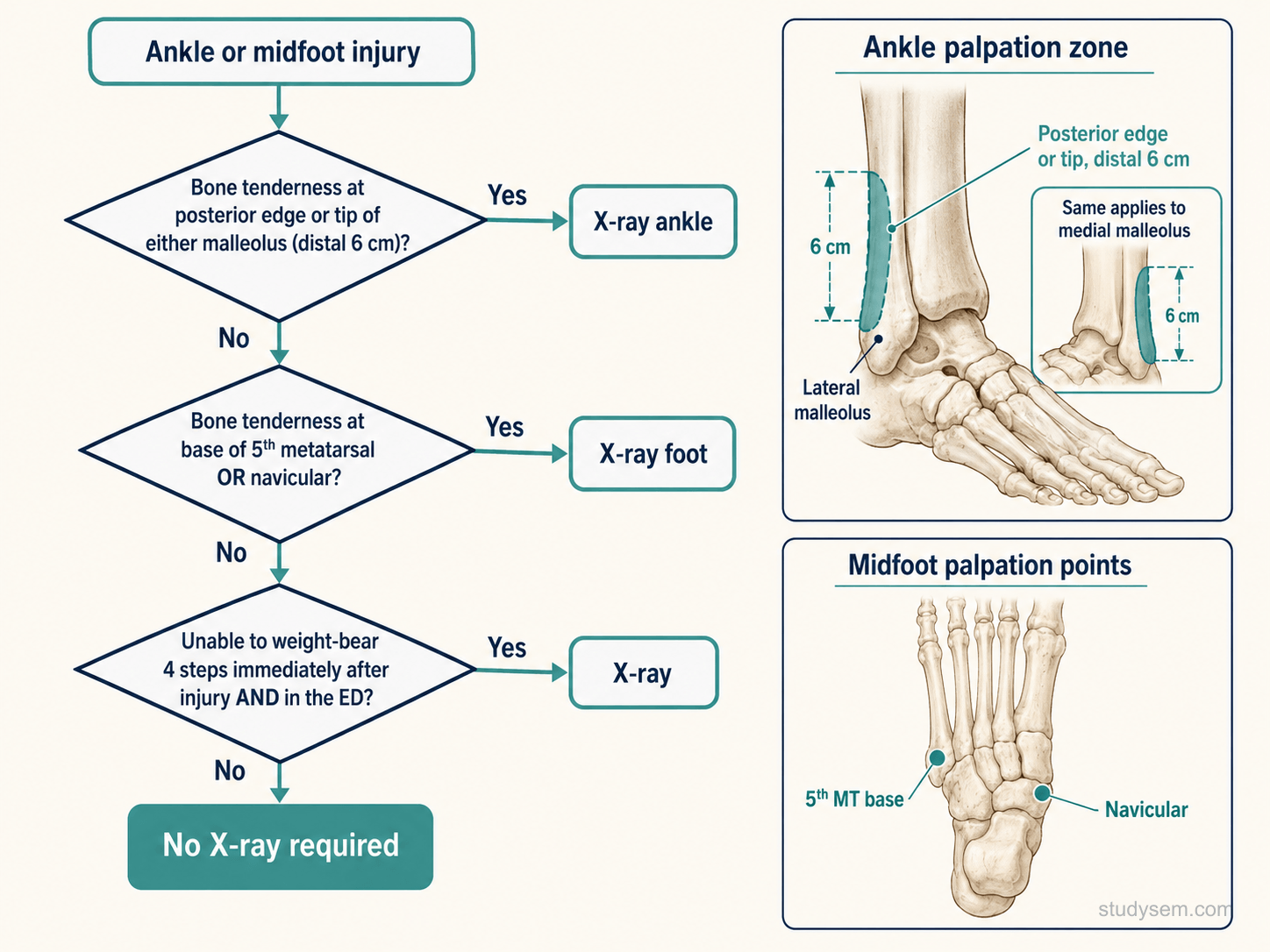 Ottawa Ankle Rules decision flowchart showing malleolar zone tenderness, midfoot tenderness at 5th metatarsal base or navicular, and inability to weight-bear 4 steps as indications for X-ray with palpation zone diagrams