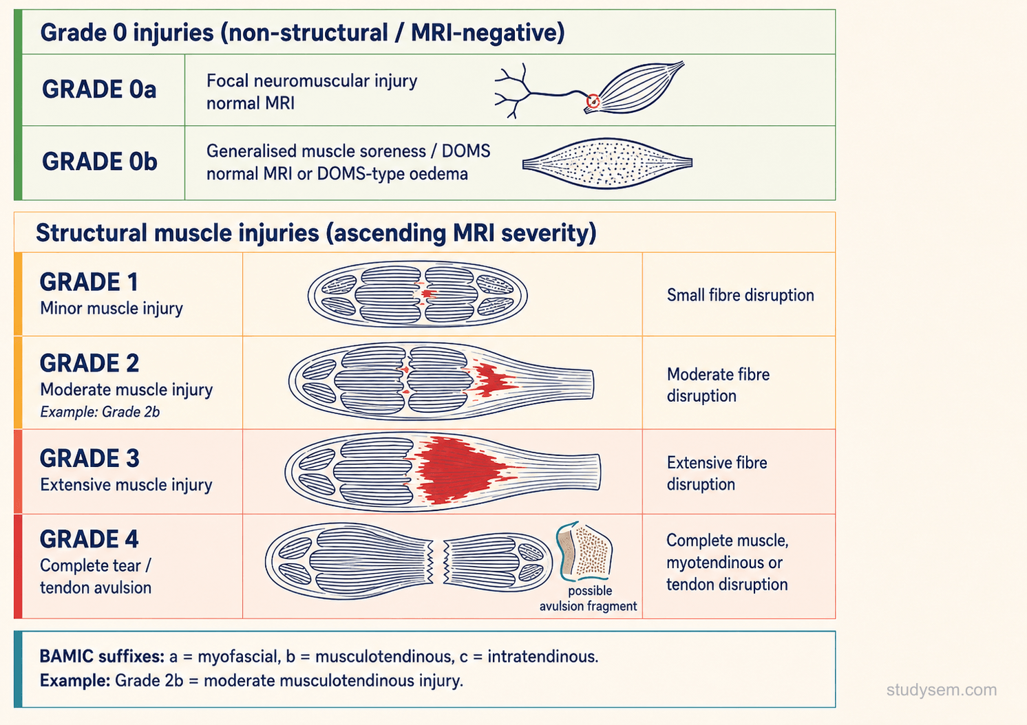 British Athletics Muscle Injury Classification (BAMIC) diagram showing functional (grade 0) through structural (grades 1-4) injuries with sub-site suffixes a (myofascial), b (musculotendinous junction), and c (intratendinous).