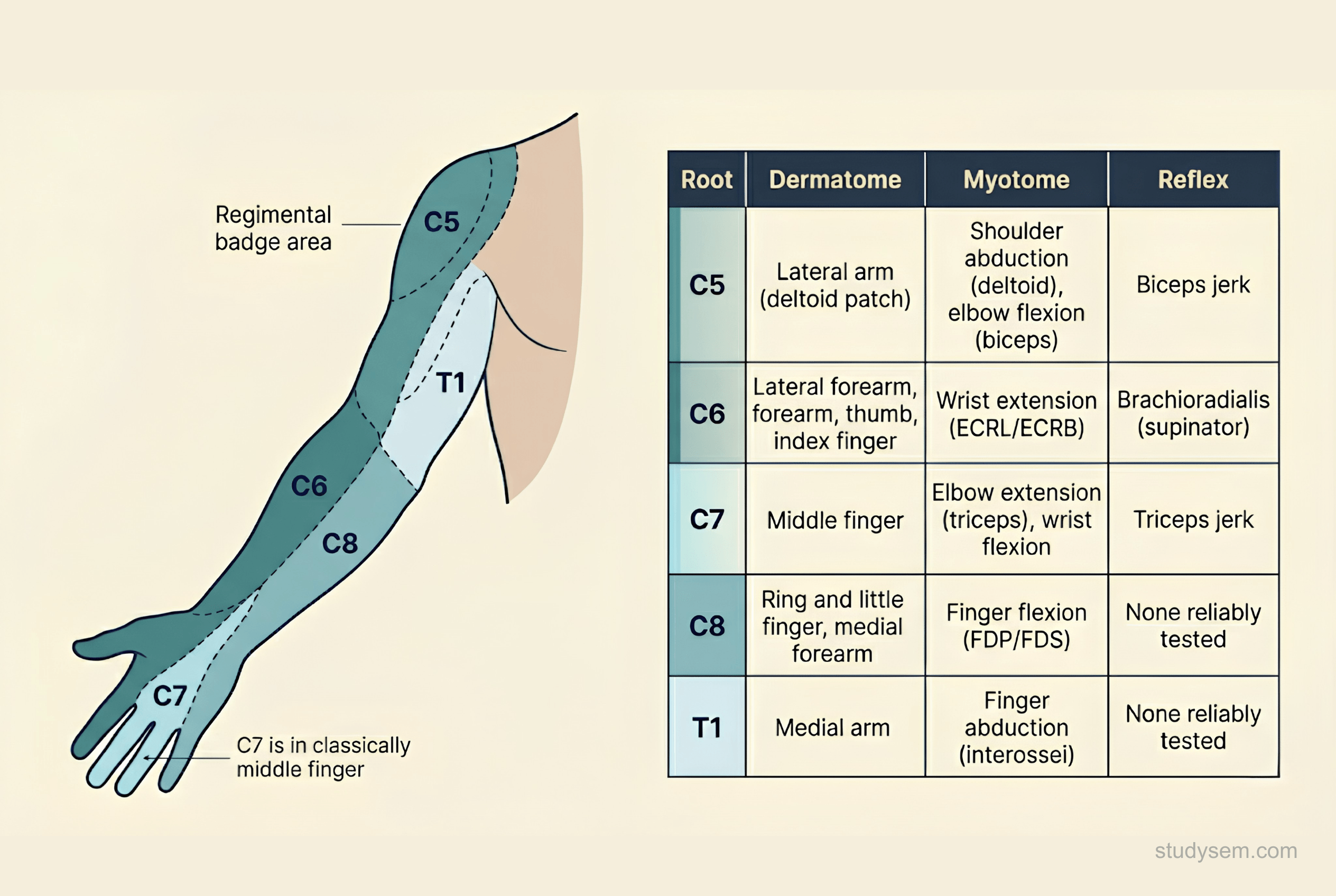 Upper limb dermatome map with myotome and reflex reference table showing C5 to T1 distributions for level localisation in cervical radiculopathy