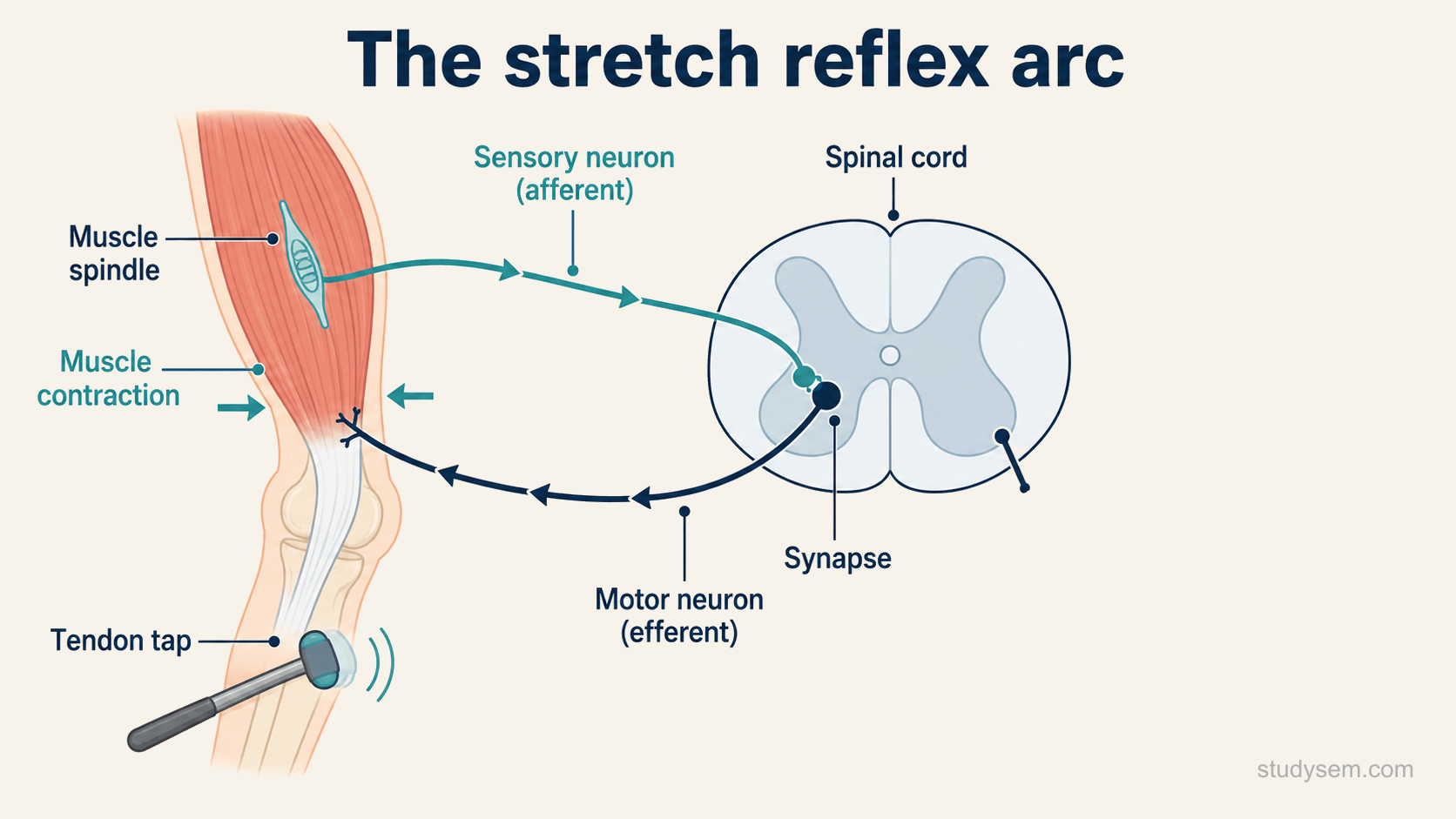 A diagram of the monosynaptic stretch reflex arc: a muscle spindle within a muscle detects stretch, a sensory (afferent) neuron carries the signal to the dorsal side of the spinal cord, where it synapses directly with an alpha motor neuron in the ventral horn, and the motor (efferent) neuron carries the signal back to the same muscle, causing it to contract; a small tendon-tap at the knee is shown as the trigger.