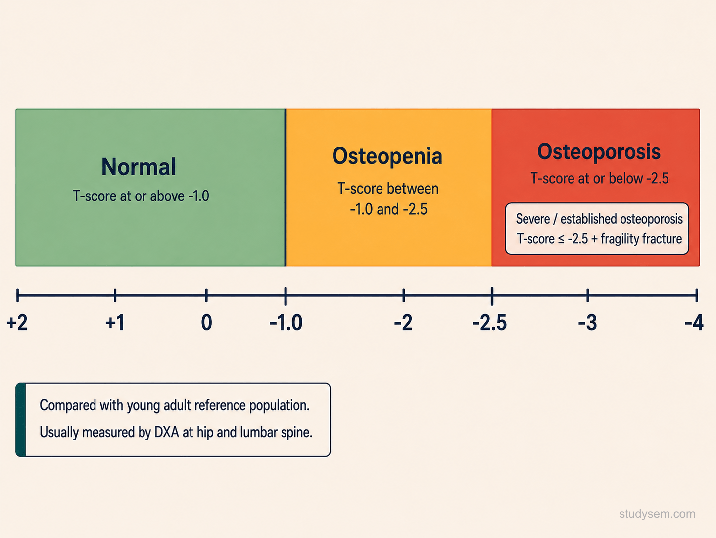 DEXA bone density distribution diagram with WHO T-score classification bands: normal (T at or above -1.0), osteopenia (-1.0 to -2.5), osteoporosis (-2.5 or below), and severe osteoporosis (-2.5 or below in the presence of a fragility fracture)