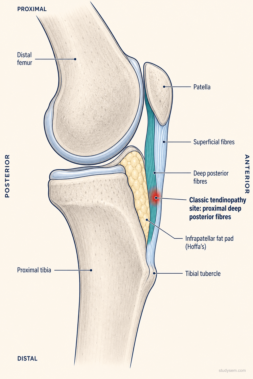 Sagittal view of patellar tendon showing deep posterior fibres at the proximal insertion on the inferior patellar pole