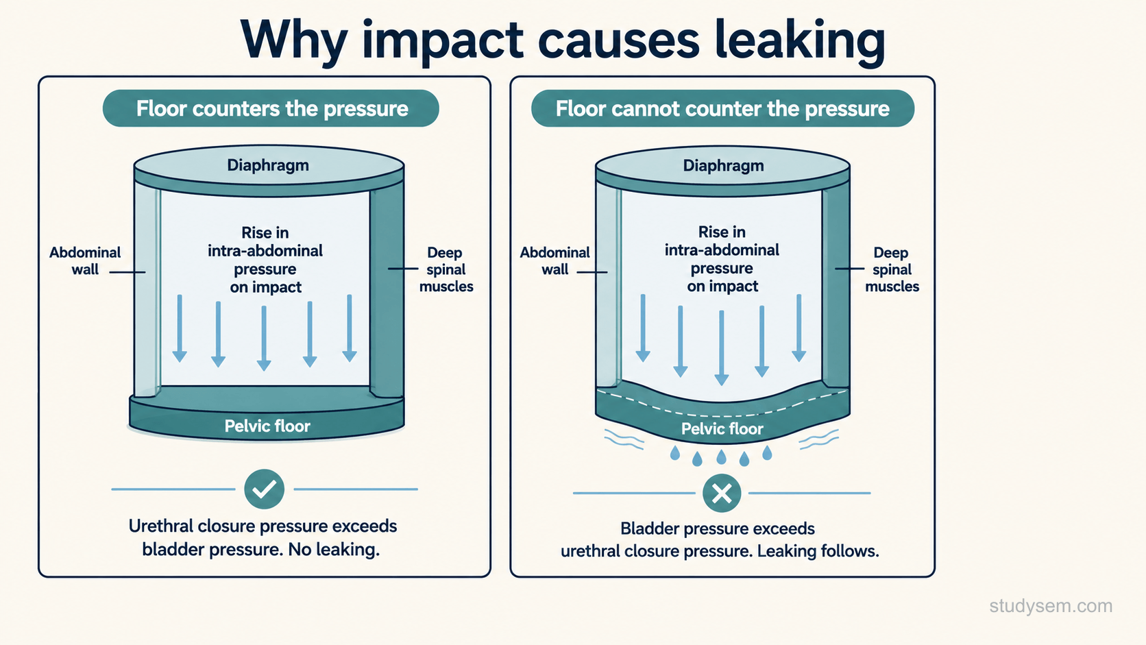 A two-panel schematic titled why impact causes leaking. Each panel shows a container labelled diaphragm at the top, abdominal wall on one side and deep spinal muscles on the other, with the pelvic floor at the base, and downward arrows for a rise in intra-abdominal pressure on impact. In the left panel the floor counters the pressure, so urethral closure pressure exceeds bladder pressure and there is no leaking. In the right panel the floor cannot counter the pressure, the base bulges and drops appear, so bladder pressure exceeds urethral closure pressure and leaking follows. Schematic containers only, with no realistic anatomy and no numeric values.