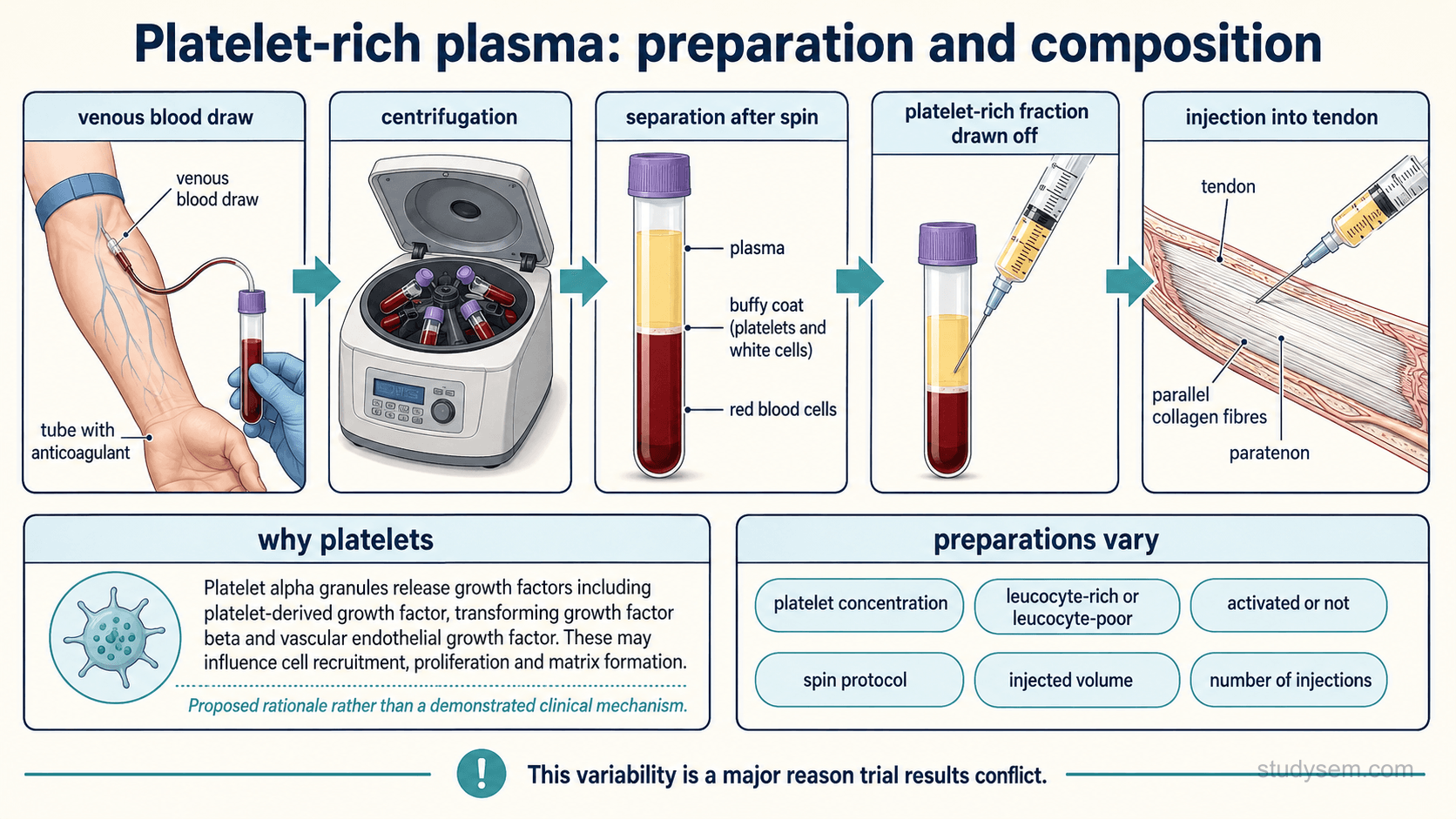 An educational figure titled 'Platelet-rich plasma: preparation and composition'. A left-to-right process flow shows venous blood drawn from the patient's arm into a tube containing anticoagulant; the tube placed in a centrifuge; the spun tube separating into labelled layers, with red blood cells at the bottom, a buffy coat containing platelets and leucocytes in the middle, and plasma above; a fraction drawn off into a syringe; and that syringe injecting an anatomically accurate tendon. A note explains that what is harvested depends on the system: leucocyte-rich preparations collect at or near the buffy coat, while leucocyte-poor preparations usually collect platelet-containing plasma while avoiding much of the buffy coat. A bordered panel headed 'why platelets' explains that platelet alpha granules release growth factors including platelet-derived growth factor, transforming growth factor beta and vascular endothelial growth factor, which may influence cell recruitment, proliferation and matrix formation, captioned as a proposed rationale. A separate bordered panel headed 'preparations vary' lists platelet concentration, leucocyte-rich or leucocyte-poor content, activation, spin protocol, injected volume and number of injections, with a caption noting this variability is a major reason trial results conflict.