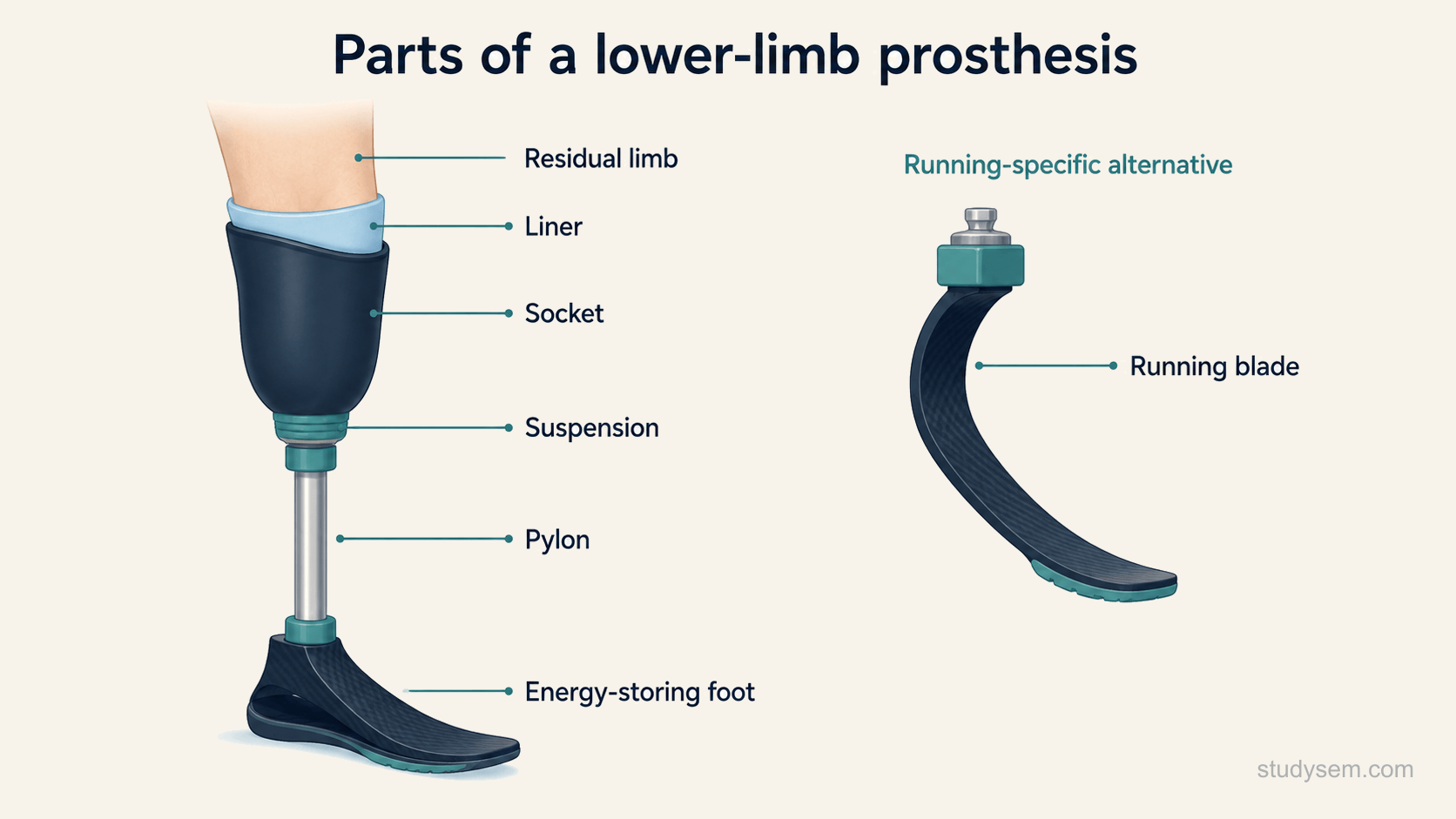 A labelled concept diagram of a lower-limb transtibial prosthesis on a residual limb, showing the residual limb within a soft liner, the custom socket, the suspension holding the limb in the socket, a pylon connecting down to an energy-storing carbon-fibre foot, and, shown alongside, a curved carbon running blade as the running-specific alternative to a foot.