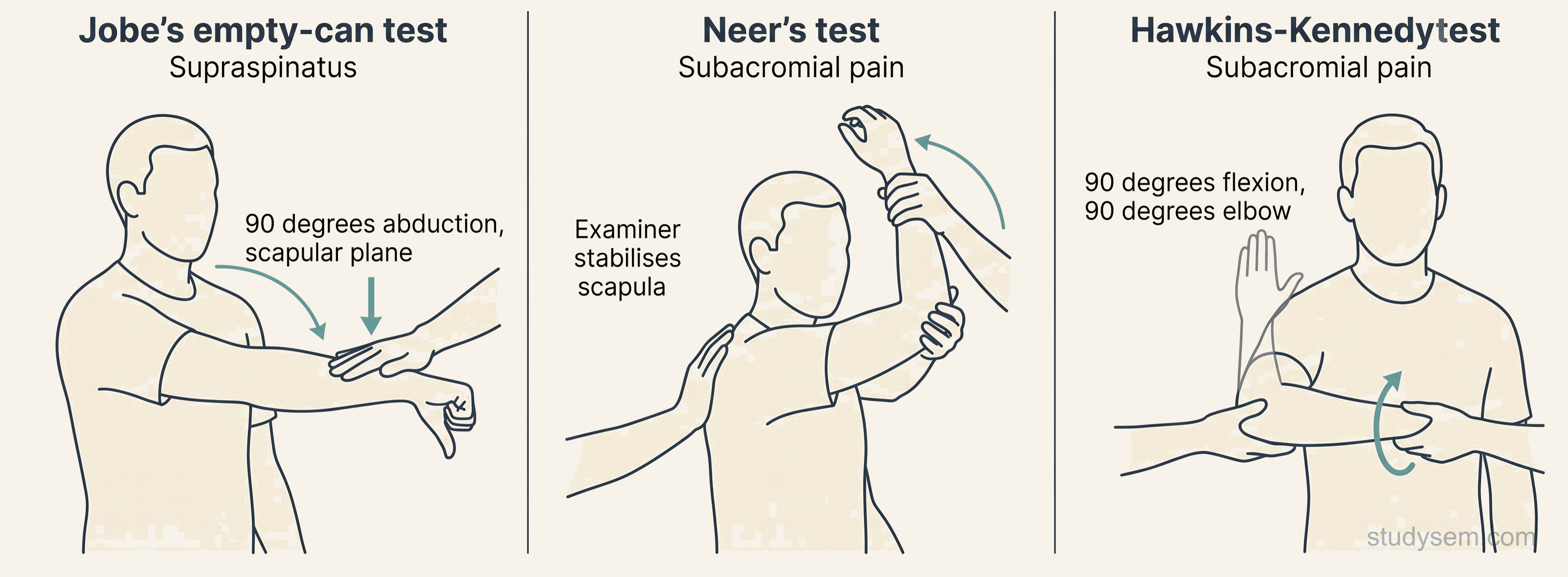 Three side-by-side examination diagrams: Jobe's empty-can test for supraspinatus, Neer's test for subacromial pain, and Hawkins-Kennedy test for subacromial pain