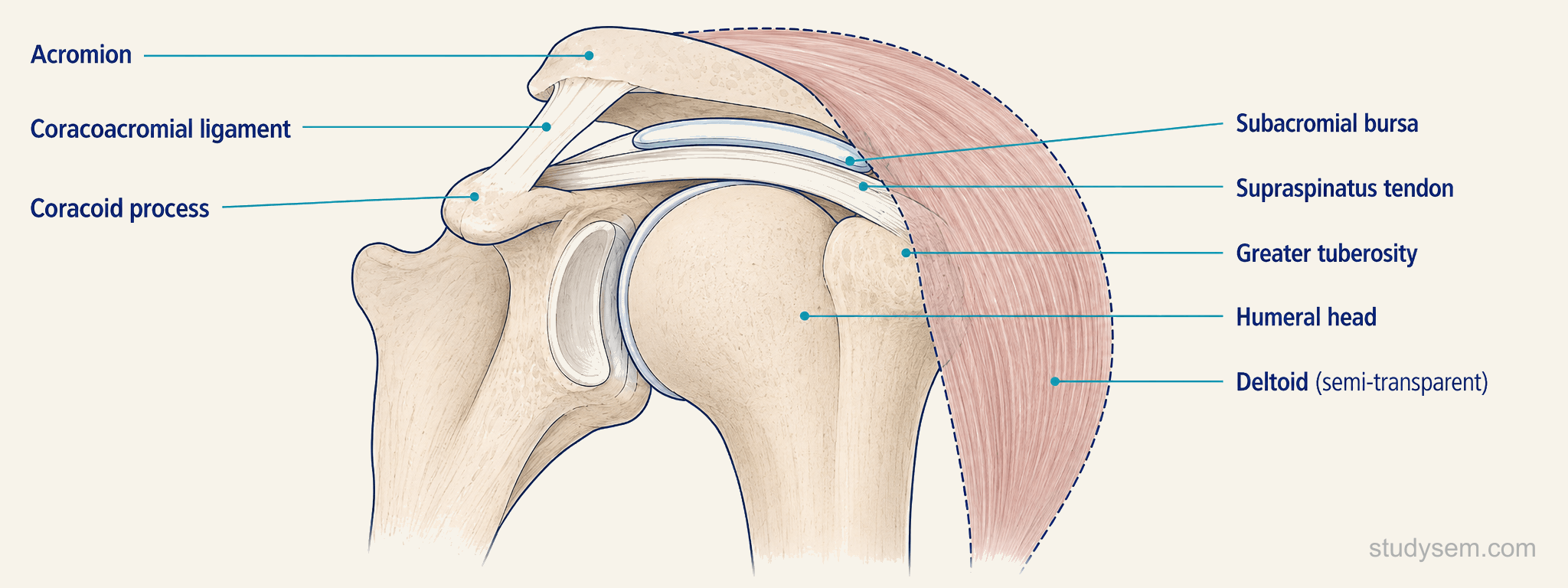 Anatomical diagram of the subacromial space showing the coracoacromial arch above and the rotator cuff tendons (primarily supraspinatus) below, with the subacromial-subdeltoid bursa between them.