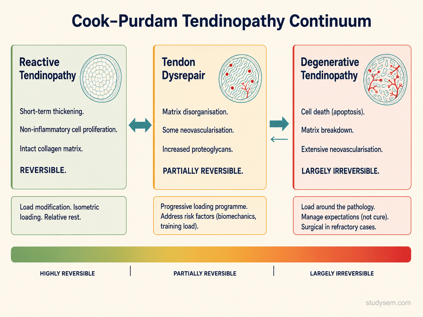 Cook and Purdam tendinopathy continuum schematic showing the three stages: reactive tendinopathy (acute overload response, swollen, reversible), tendon dysrepair (failed healing with collagen disorganisation and neovascularisation, partially reversible), and degenerative tendinopathy (matrix breakdown, cell death, limited structural reversal but function improves by loading remaining healthy tissue). Bidirectional arrows show that load management drives transitions between stages.