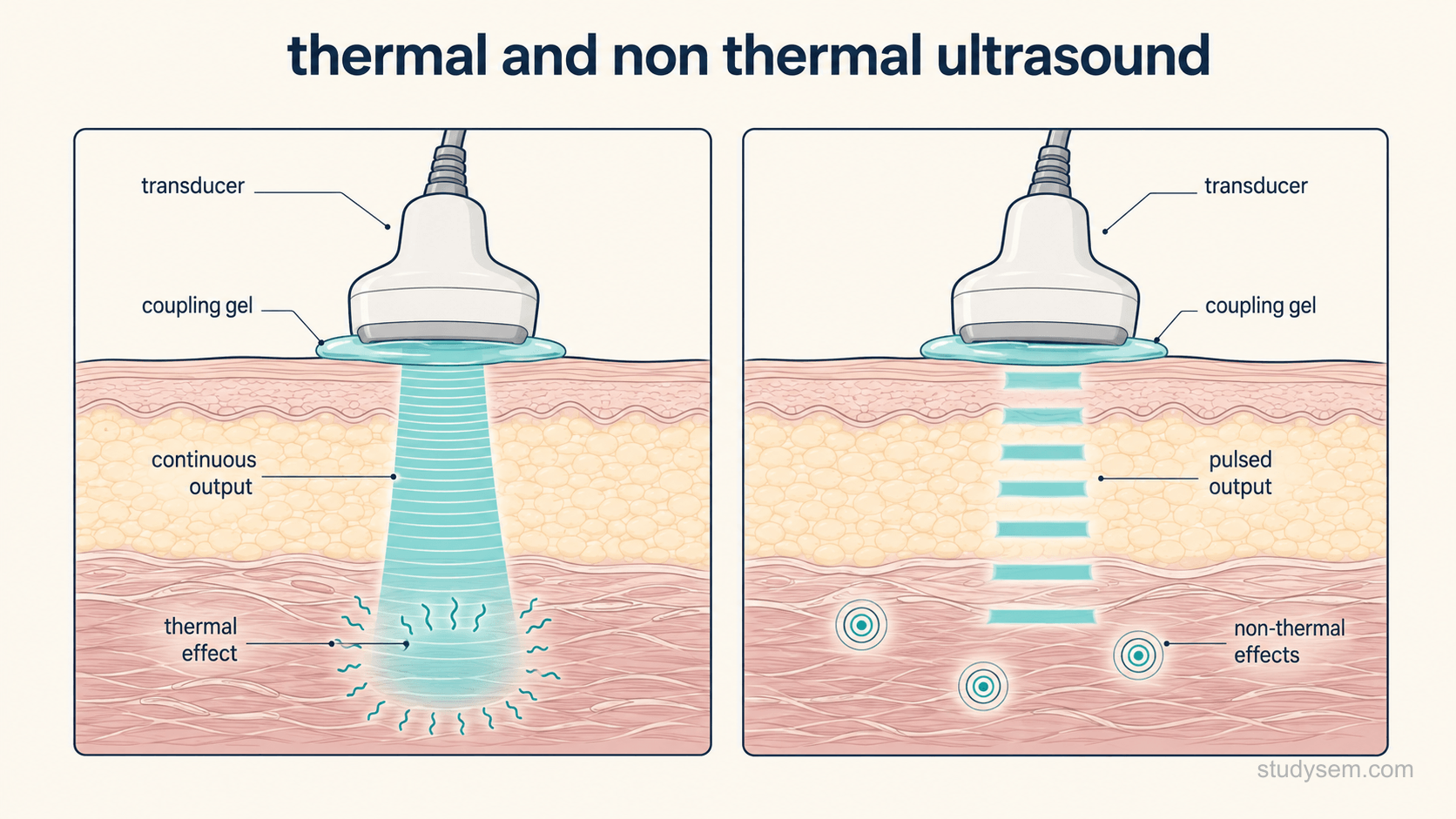 Two side-by-side cross-sections of skin, subcutaneous fat and underlying soft tissue on a cream background, each with a handheld transducer and coupling gel on the surface. The left panel, labelled continuous, shows a continuous band of energy entering the tissue with several radiating heat marks in the deeper layer. The right panel, labelled pulsed, shows the same beam broken into separated pulses with gaps between them, with fewer heat marks and small circular symbols in the tissue indicating proposed mechanical effects. Labels only: transducer, coupling gel, continuous output, greater heating, pulsed output, reduced thermal exposure, proposed mechanical effects.